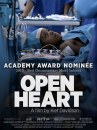 Open Heart locandina e immagini 2